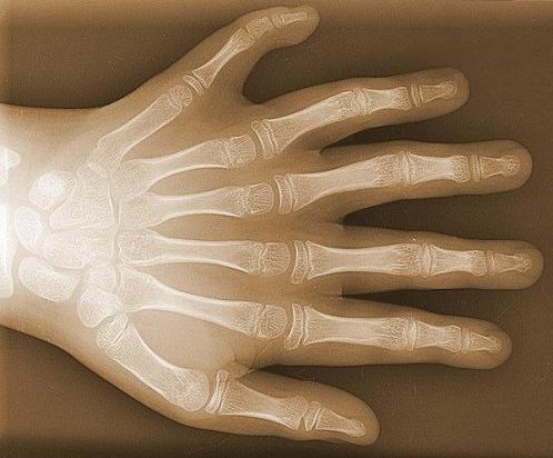 Geplaatst op 12 februari 2010  a