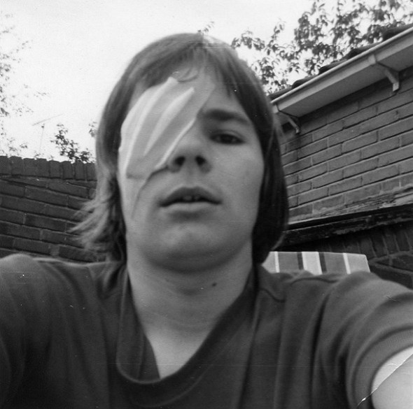selfie met lap voor het oog (1972)